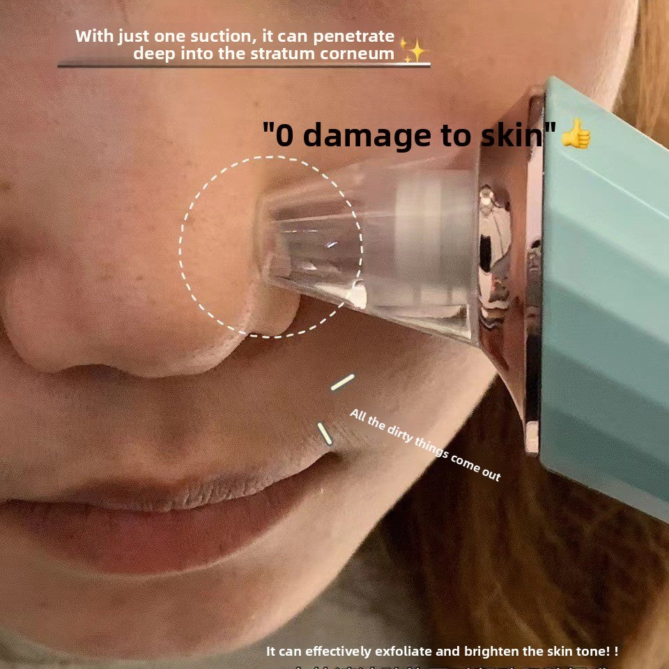 SuperElectric Blackhead Remover Device™